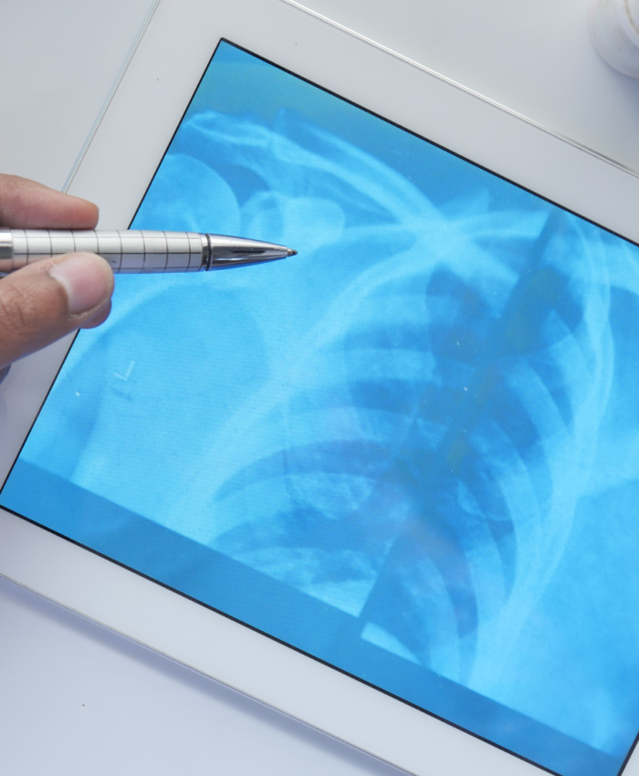 STF decide: INSS pode encerrar auxílio-doença automaticamente, sem nova perícia